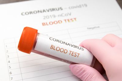 Pracodawca nie może zmusić pracownika do wykonania badania na koronawirusa